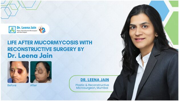 A post-COVID Mucormycosis Survivor gets a New Lease on Life after Dr Leena Jain…